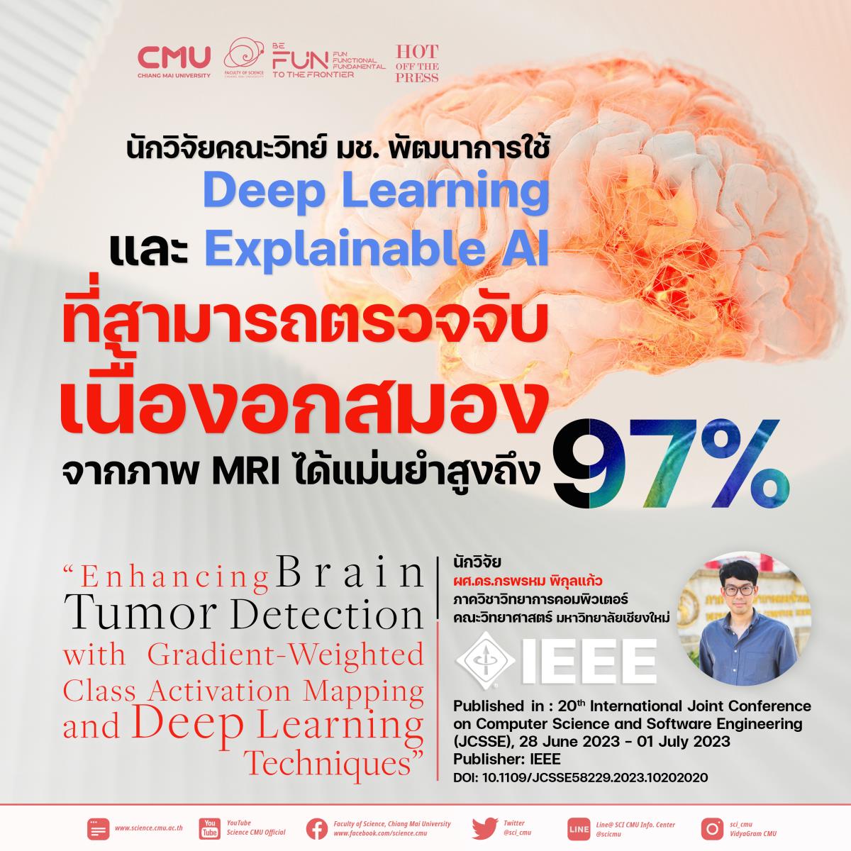นักวิจัยคณะวิทย์ มช. พัฒนาการใช้ Deep Learning และ Explainable AI สามารถตรวจจับเนื้องอกในสมองได้แม่นยำสูงถึง 97%